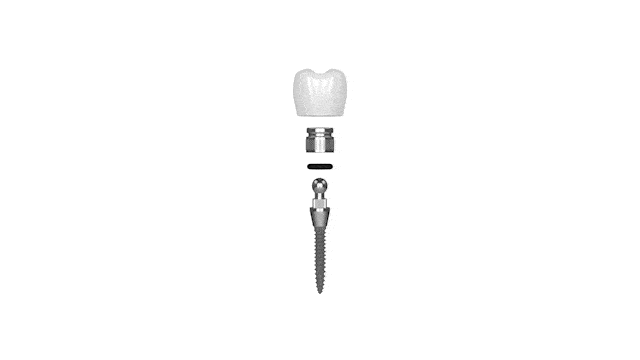 Mini Dental Implants Cost in Schaumburg, IL | Free Consultations