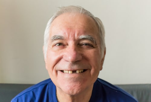 Teeth Replacement Options | Restoring Smiles in Schaumburg, IL