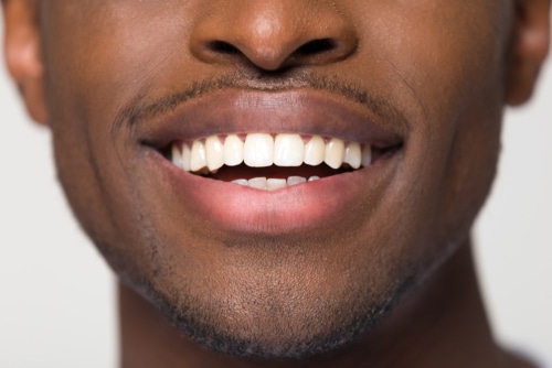 Cosmetic Dentist in Schaumburg, IL | Revitalize Your Smile Today!
